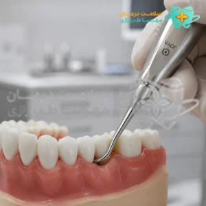 استفاده از الواتور مستقیم جویا در لوکساسیون و جراحی کشیدن دندان